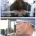 음주 운전 사고를 당한 피해자의 몸.jpg