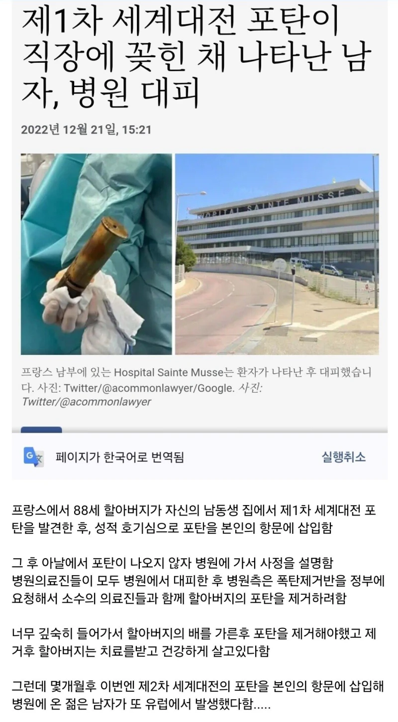 제1차 세계대전 포탄을 항문에 넣은 남자