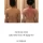(ㅇㅎ?) 승모근 교정 후기,jpg