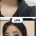 볼때마다 놀라운 성형 비포 에프터.jpg