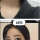 볼때마다 놀라운 성형 비포 에프터.jpg