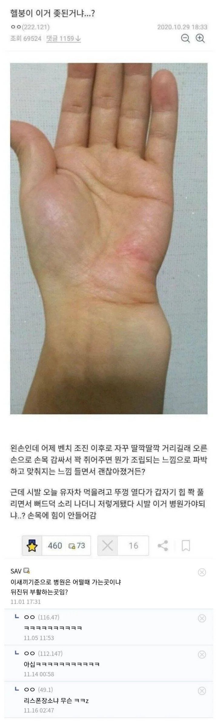의사도 웃참실패한 손목 브레이커.jpg