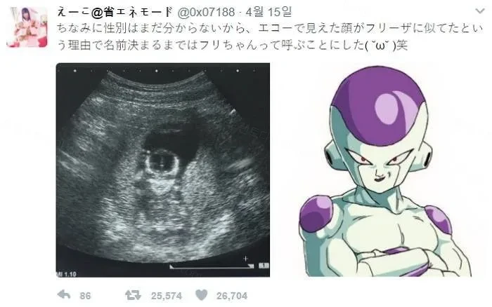 초음파 사진의 상태가?