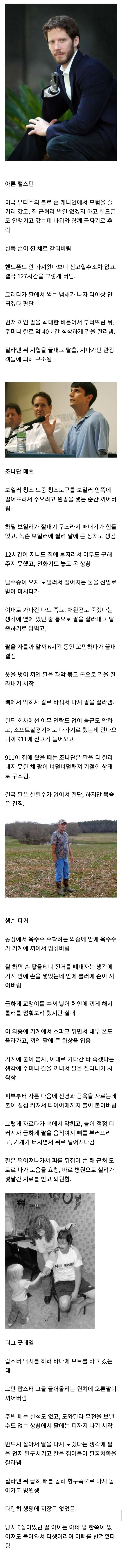 살기 위해 스스로 팔을 잘라낸 사람들