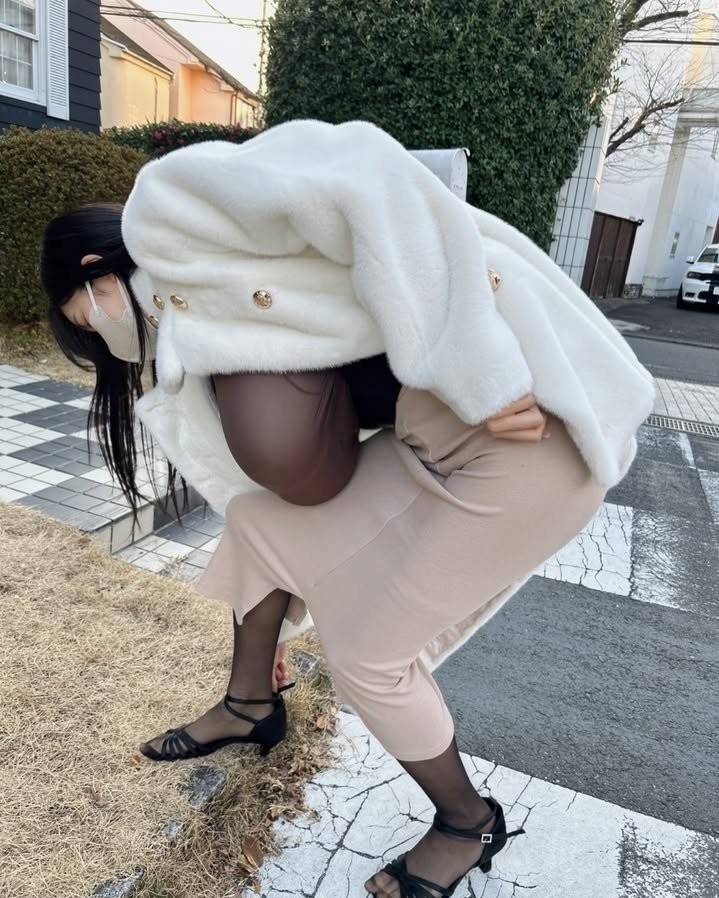 이정도면 진짜 일상생활 불가능할듯한 크기인데 ㄷㄷ