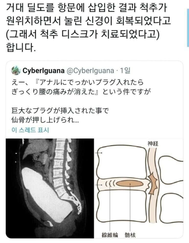 거대 딜도의 효능 ㄷㄷㄷ