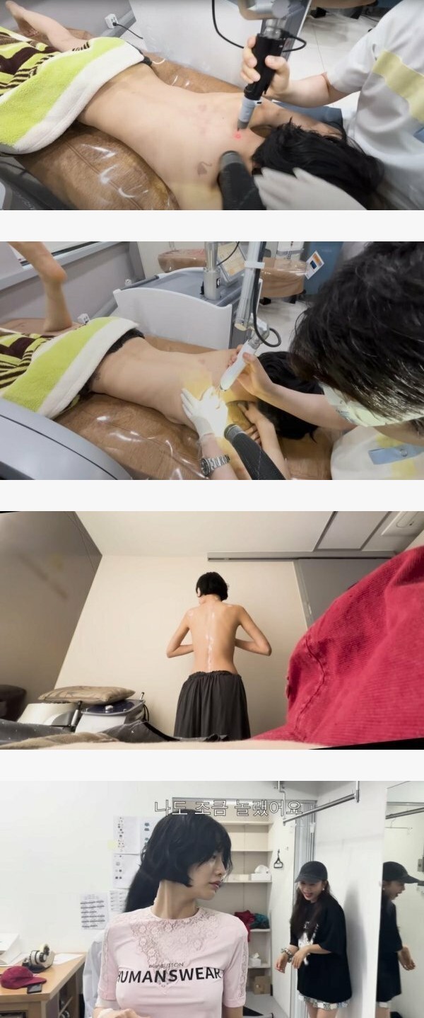 문신 지우는 나나 누나 ㄷㄷ