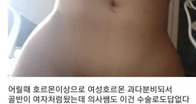 수백번 강조해도 지나치지 않을 골반의 중요성