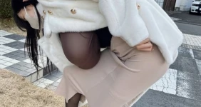 이정도면 진짜 일상생활 불가능할듯한 크기인데 ㄷㄷ