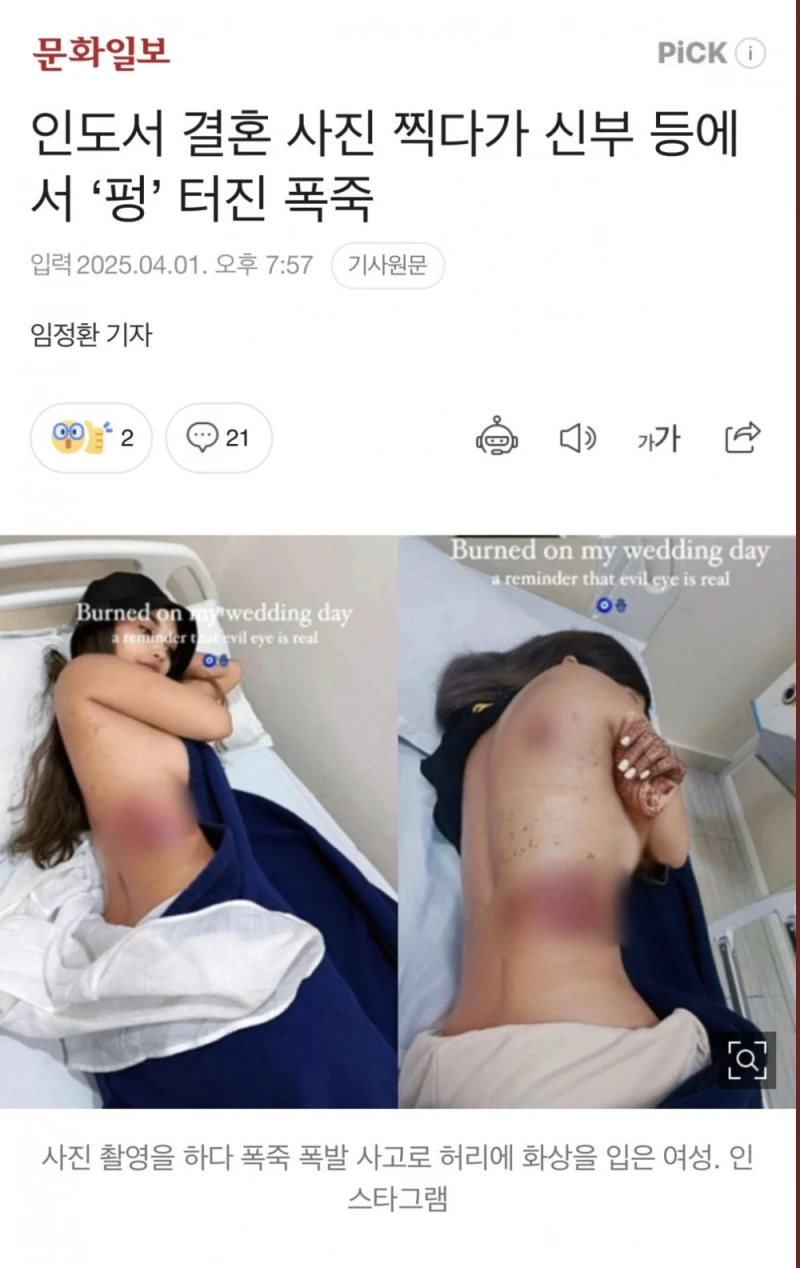 결혼사진 찍다가 등에 폭죽맞은 신부 인증샷