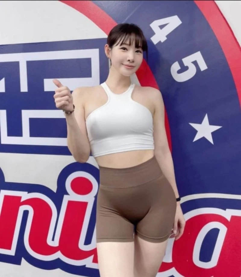 리듬체조 신수지 성형 전 & 후-5