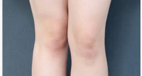 반박 거절하는 실제 평균 미시 몸매체형