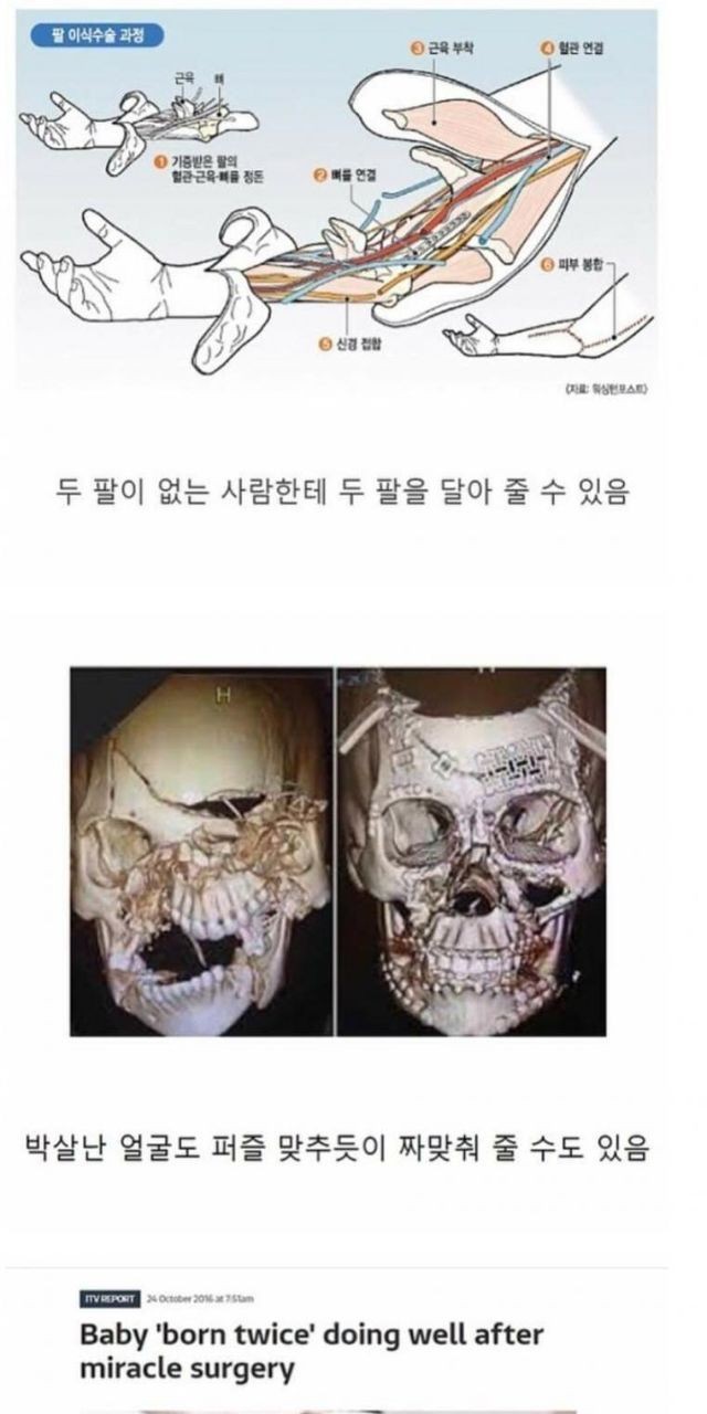 (의학) 현대 의학의 위대함.JPG