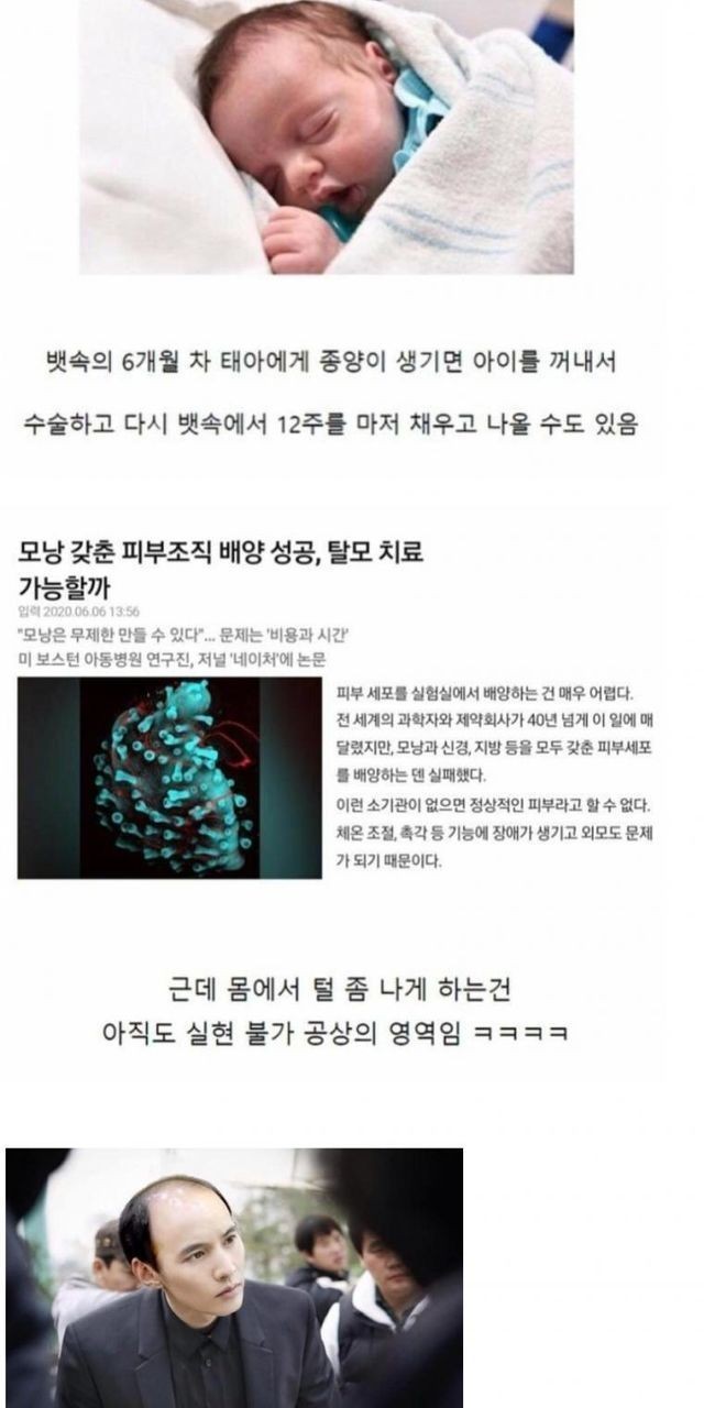 (의학) 현대 의학의 위대함.JPG-2