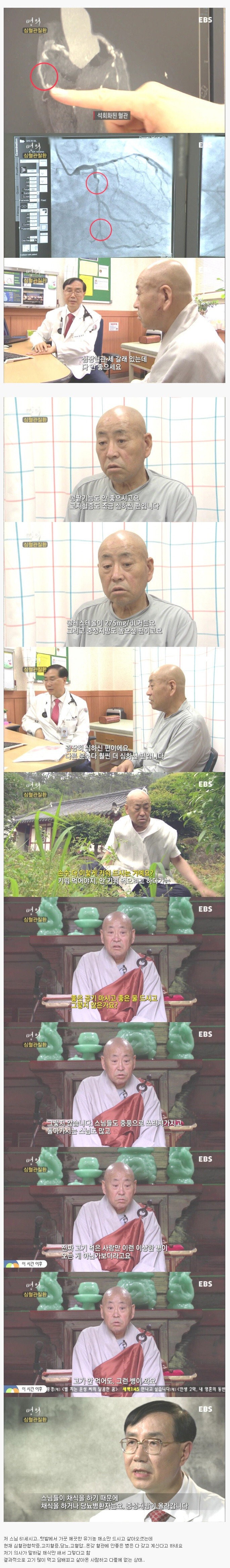 채식주의자 61세 스님의 건강상태
