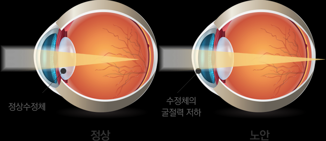 젊음이 끝났다는 신호