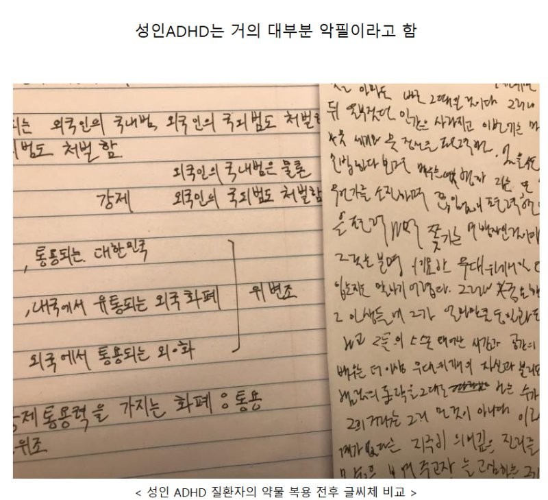 성인 ADHD의 특징 -2