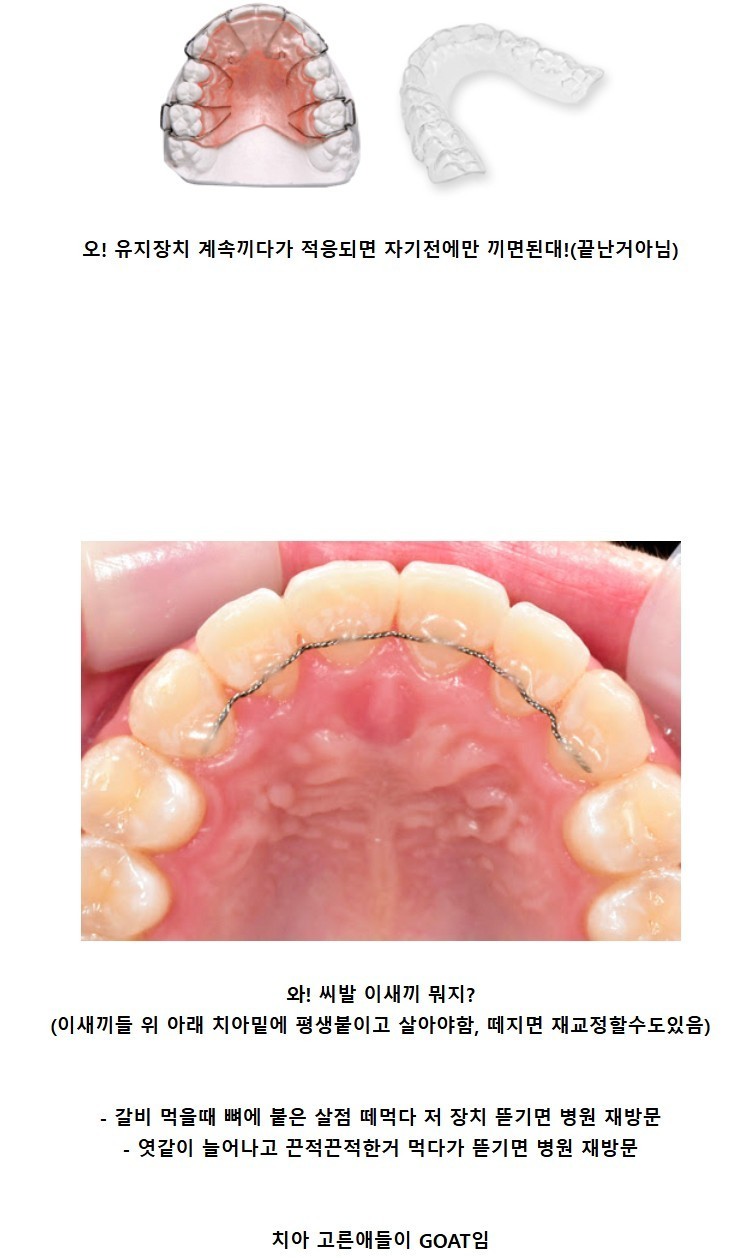 대부분 모르는 치아 교정인들의 삶-2