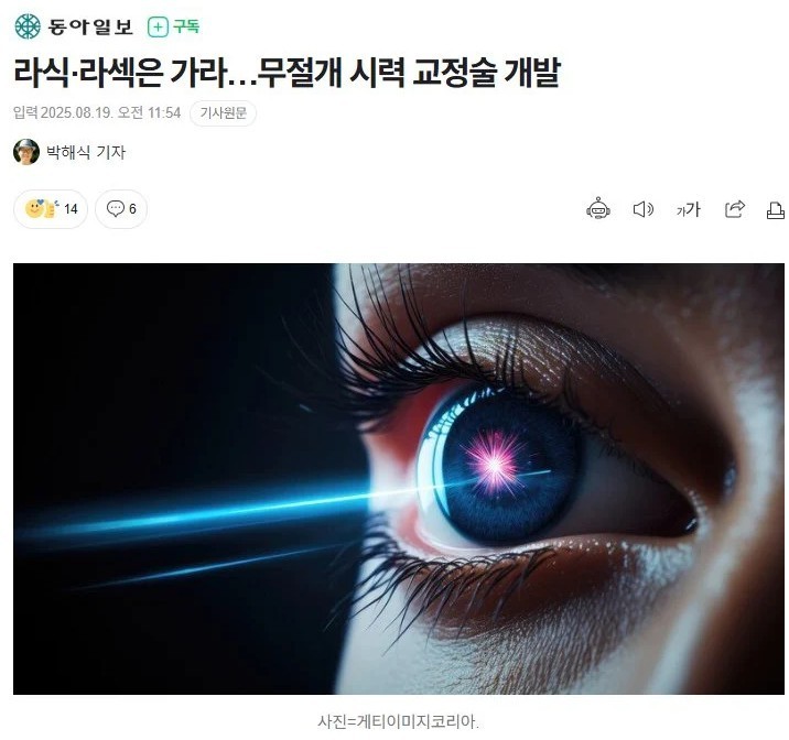라식, 라섹 뛰어넘는 시력 교정술 개발 ㄷㄷ