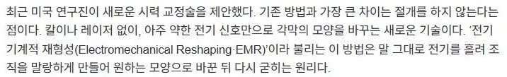 라식, 라섹 뛰어넘는 시력 교정술 개발 ㄷㄷ-2