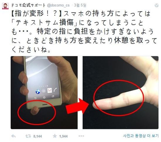 핸드폰 때문에 새끼손가락 변형 온 사람들의 모임-3
