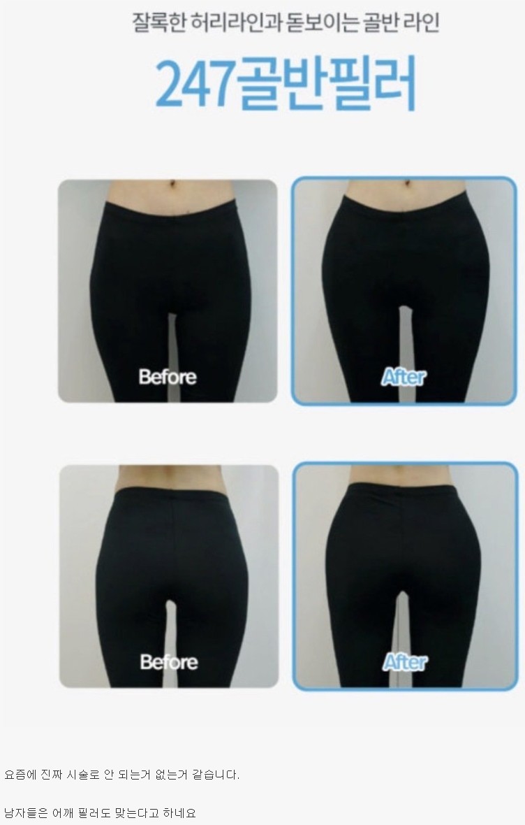 효과 확실하다는 골반 필러