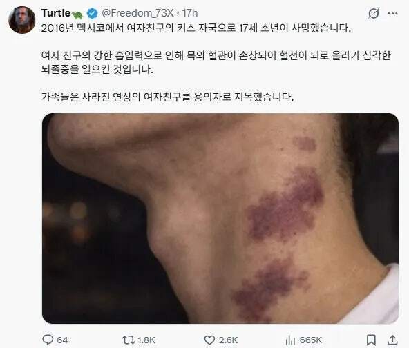 목에다 키스하면 안되는 이유