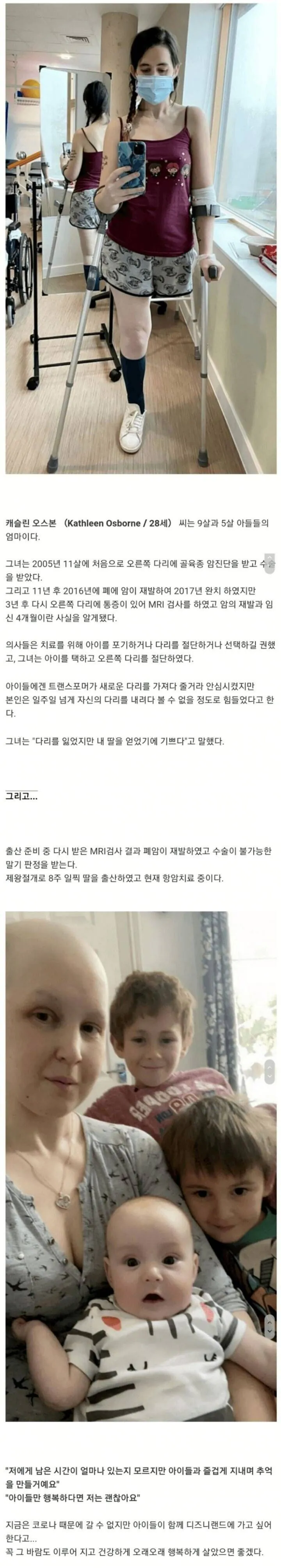 아이를 낳기위해 다리를 절단