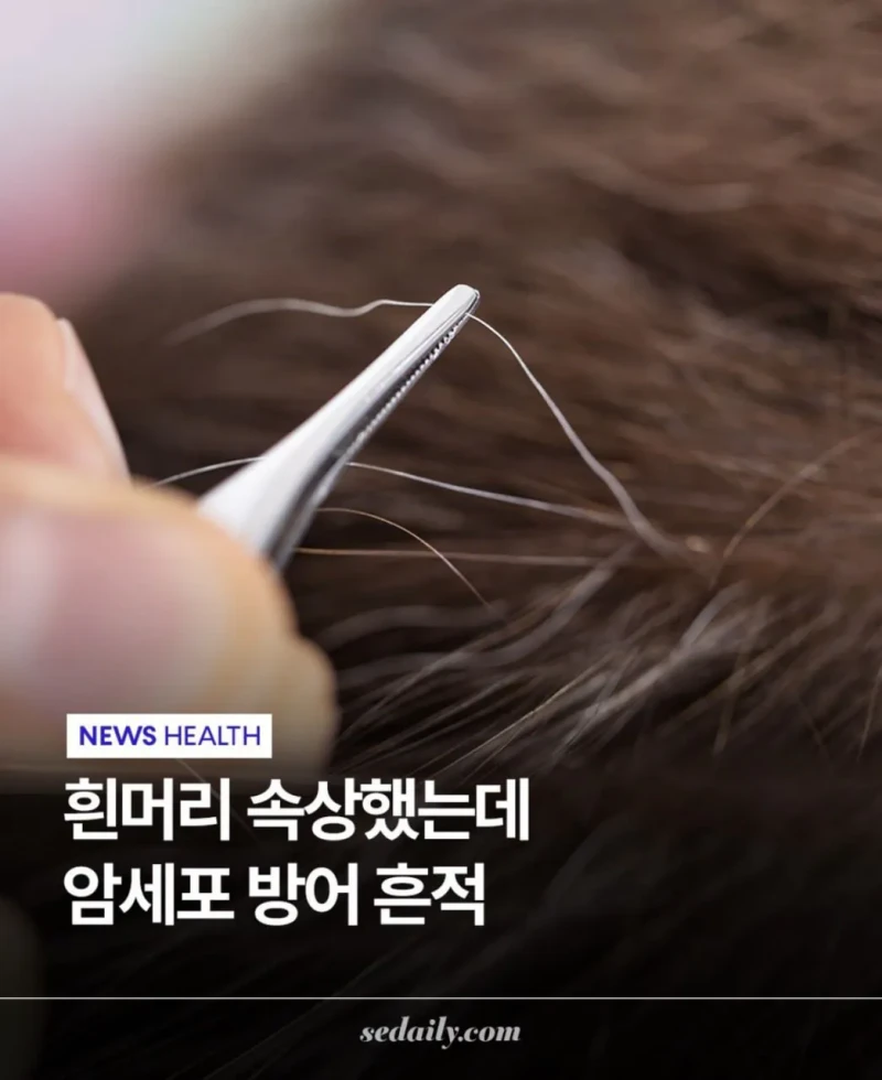 도쿄대에서 밝혀낸 흰머리의 비밀 
