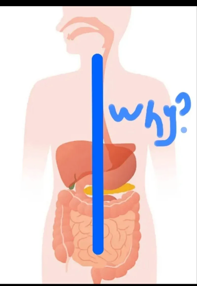 외국에서 유행했던 Why 밈-8