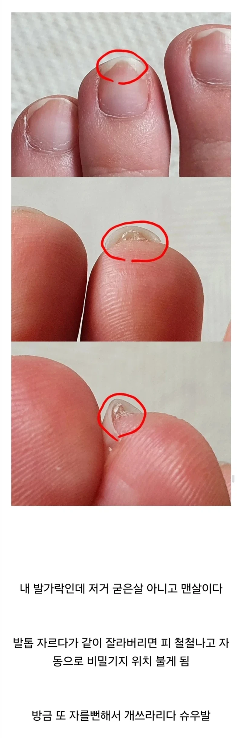 저주받은 발가락