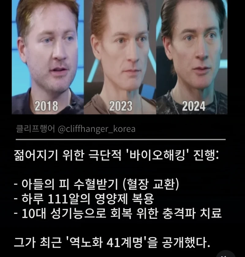 역노화에 투자하던 사업가의 결론-2
