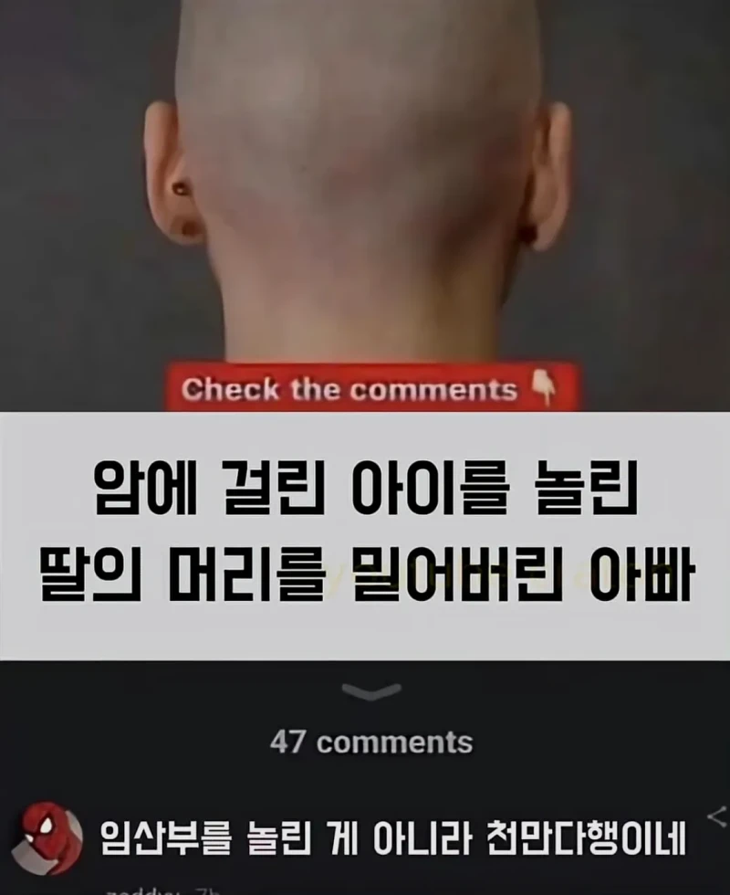 암에 걸린 아이를 놀린 딸의 머리를 밀어버린 아빠