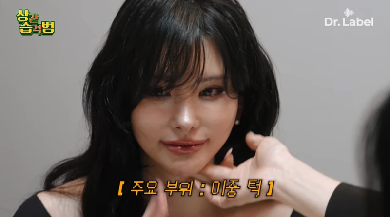 요즘 고령층 사이에서 엄청 유행중이라는 시술-8