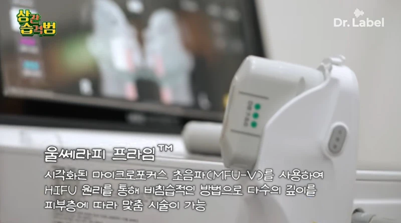 요즘 고령층 사이에서 엄청 유행중이라는 시술-9