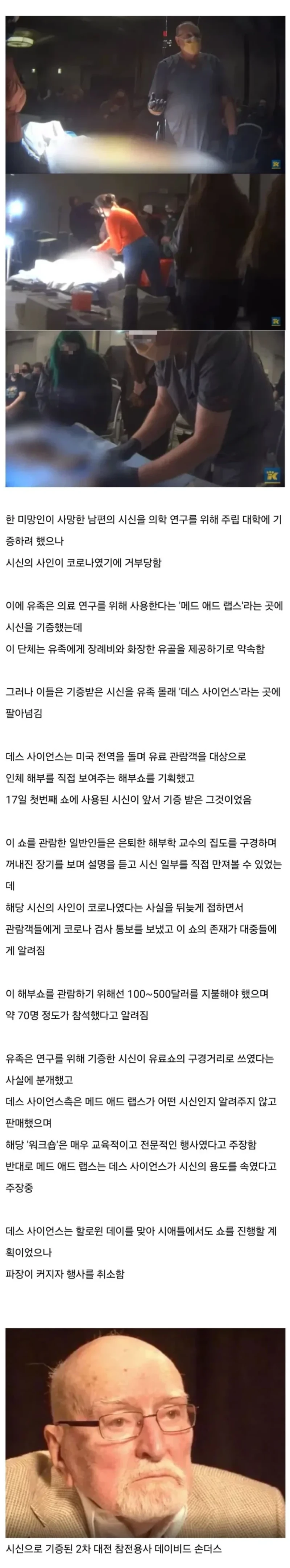 미국에서 벌어진 시체 공개 해부쇼 사건