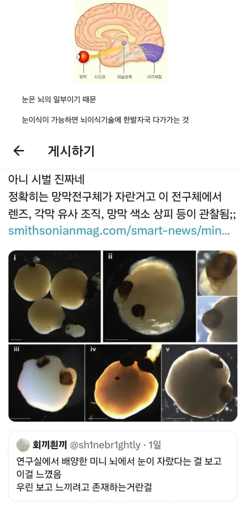 간, 심장이식은 있지만 눈이식은 없는 이유