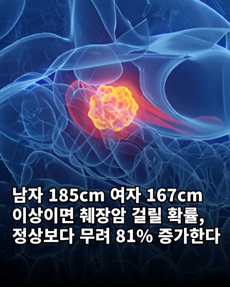 남들보다 췌장암 걸릴 확률 높은 사람 특징