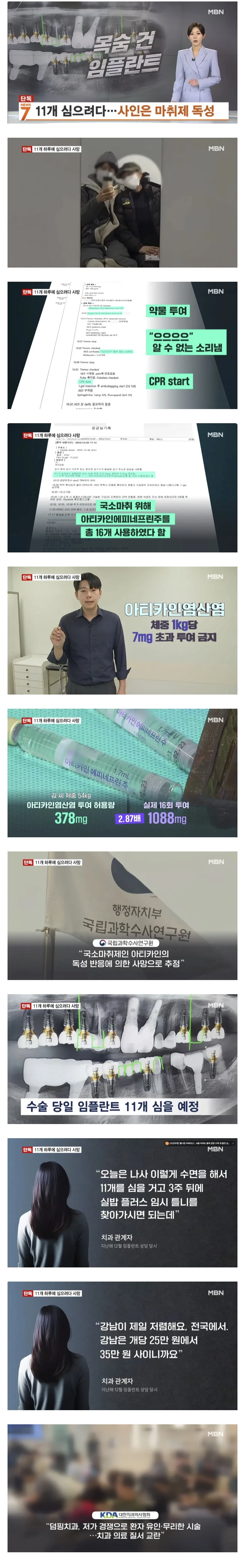 임플란트 11개 하루에 심으려다 마취제 독성때문에 사망