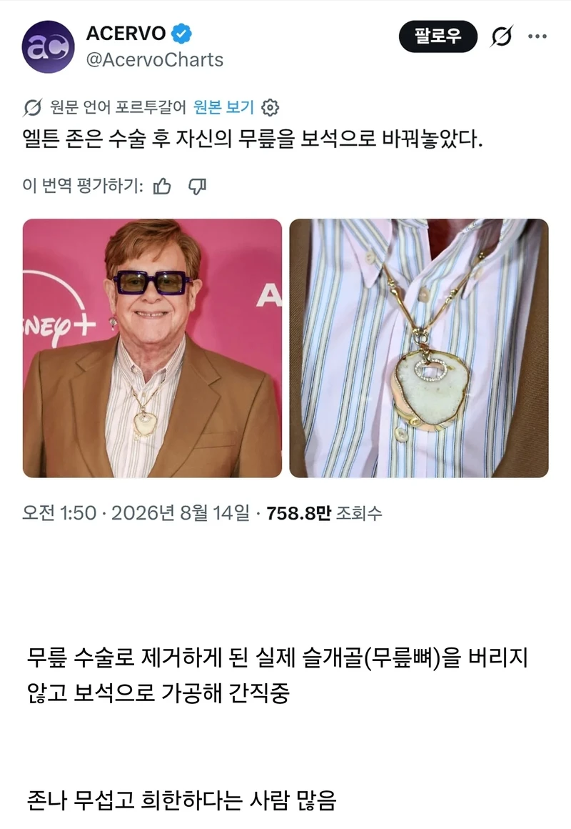 무섭다는 반응 많은 엘튼존 목걸이-2