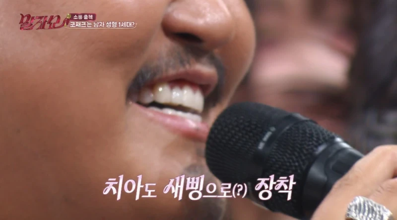 성형한 얼굴이라고 하면 모두 의아해하는 가수-15