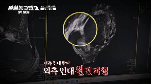 외측인대 완전파열 부상 겪고 6주만에 코트 복귀했다는 남자.jpg-9