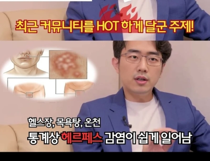 헤르페스 성병 퍼지는 이유