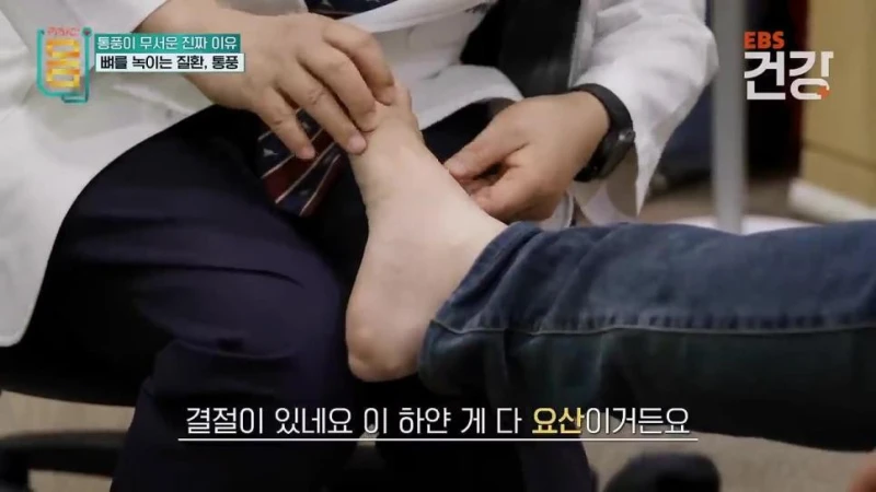 30대 통풍 환자의 발상태 .jpg-6