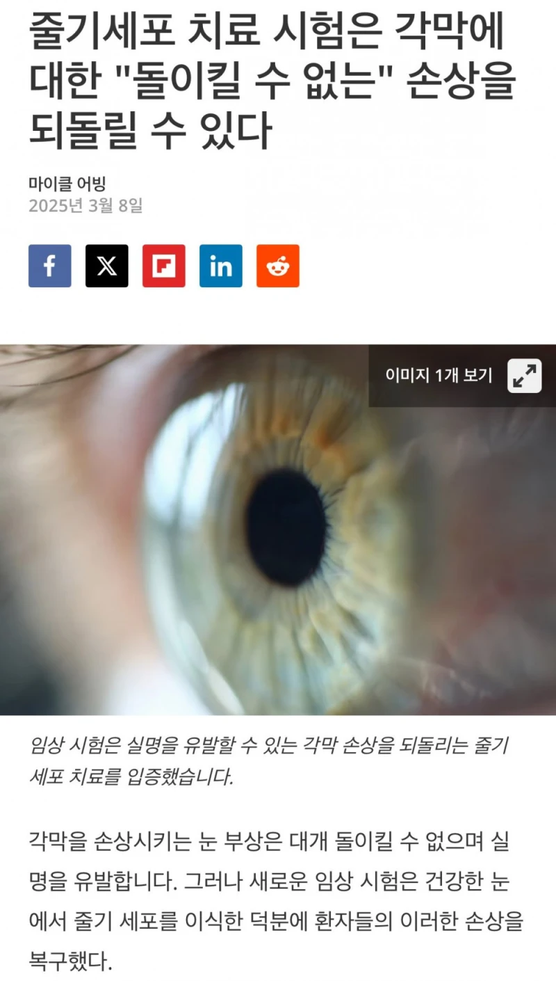 줄기세포로 불가능했던 각막치료 성공 소식
