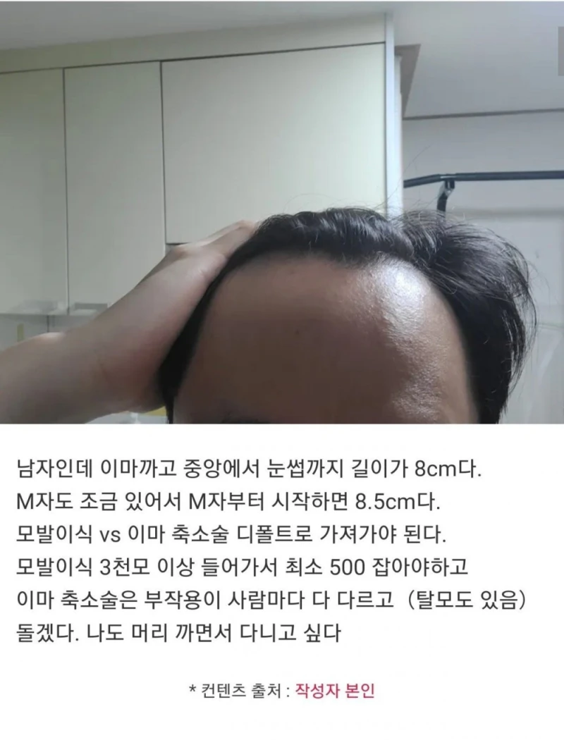 이마 8cm다...자괴감든다....