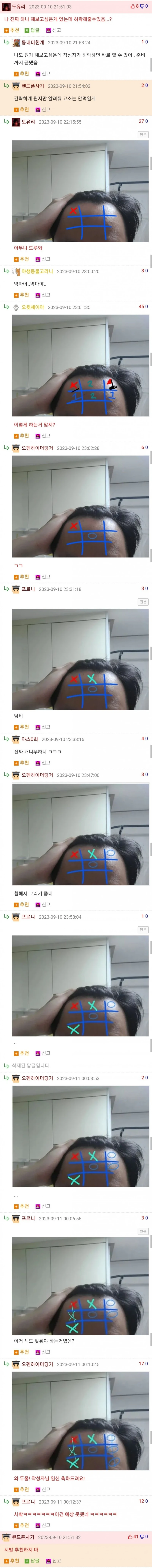 이마 8cm다...자괴감든다....-2