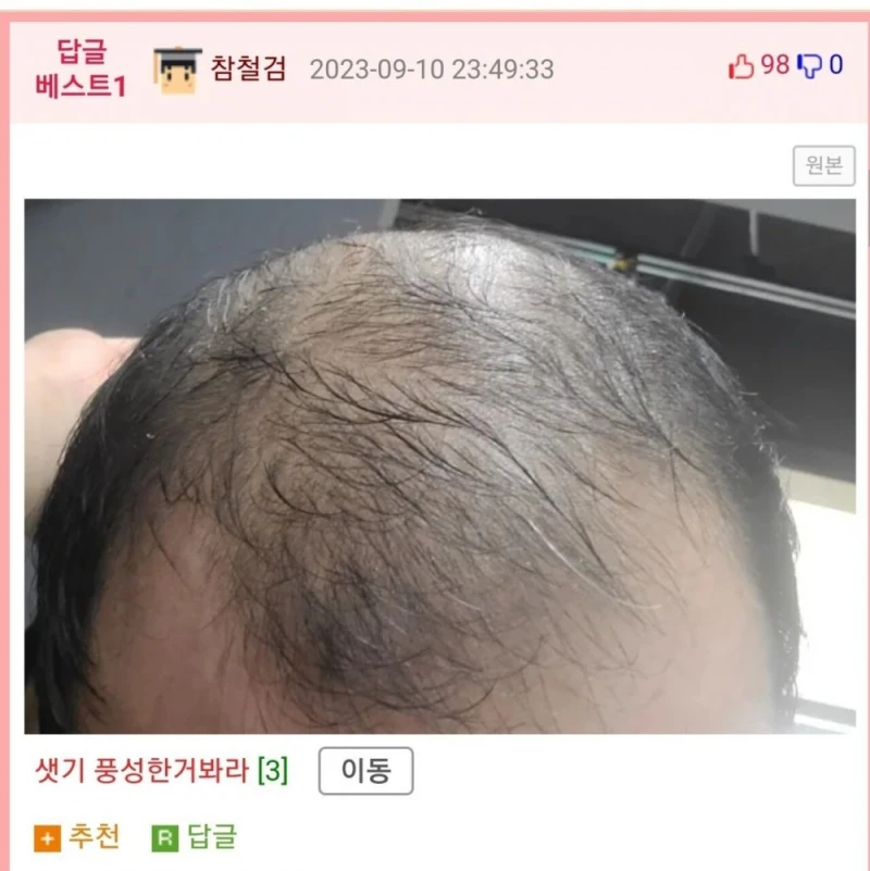 이마 8cm다...자괴감든다....-3