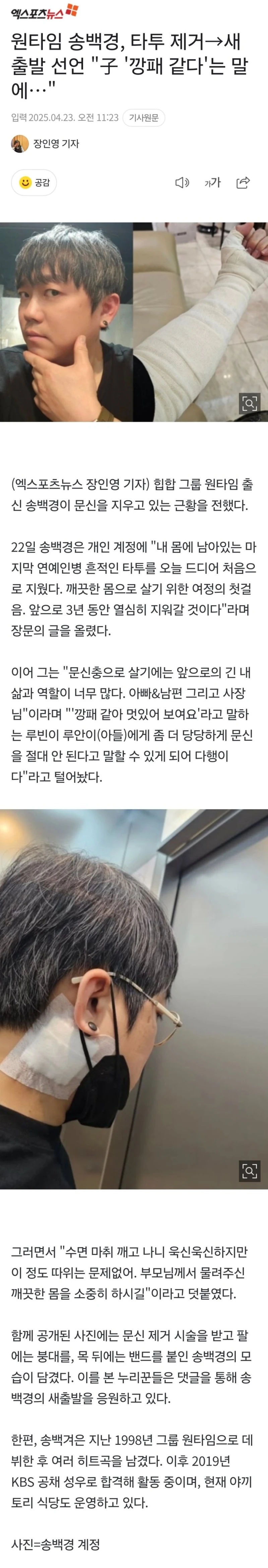 송백경, 타투 제거 중 "아들이 '깡패 같다'는 말에.."