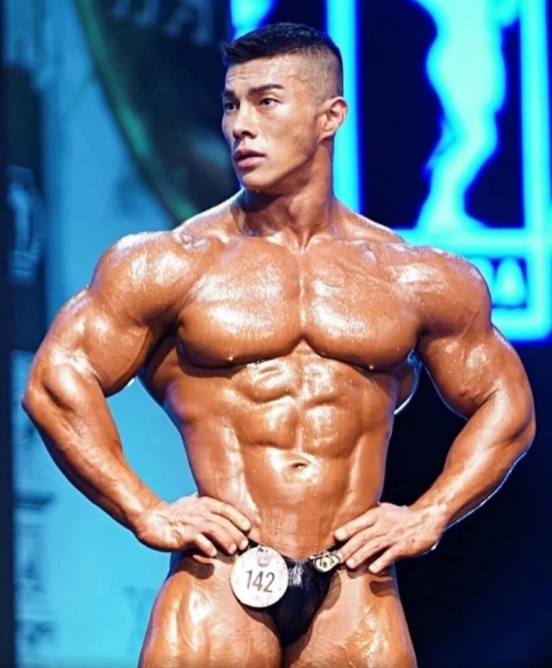 스테로이드 부작용 근황 ㄷㄷ 